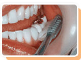 칫솔모를 치아 바깥쪽 잇몸으로 향한 이미지